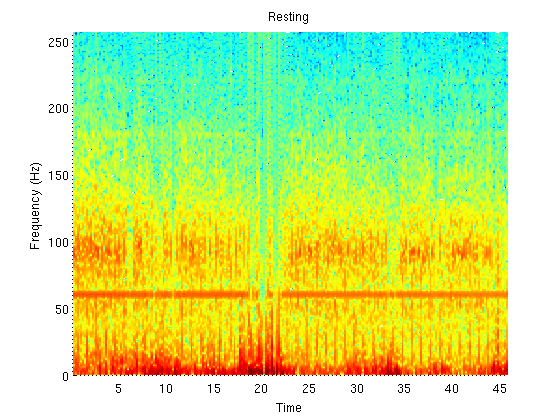 An example of a resting spectrogram