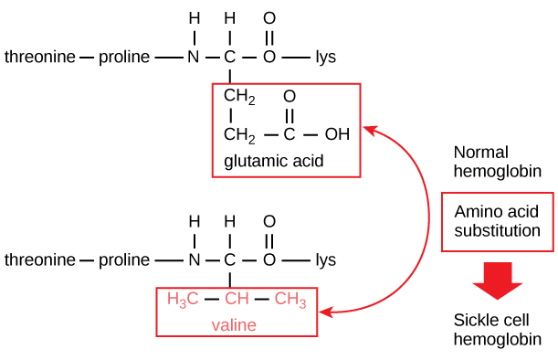 A portion of the hemoglobin amino acid sequence is shown. The normal hemoglobin beta chain has a glutamate at position six. The sickle cell beta chain has a valine at this position.