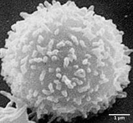 Micrograph shows a cell that looks like a fuzzy snowball.