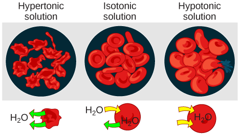 Illustration of red blood cells in hypotonic, isotonic, and hypertonic solutions. In the hypertonic solution, the cells shrivel and take on a spiky appearance. In the isotonic solution, the cells are normal in appearance. In the hypotonic solution, the cells swell and one has ruptured.