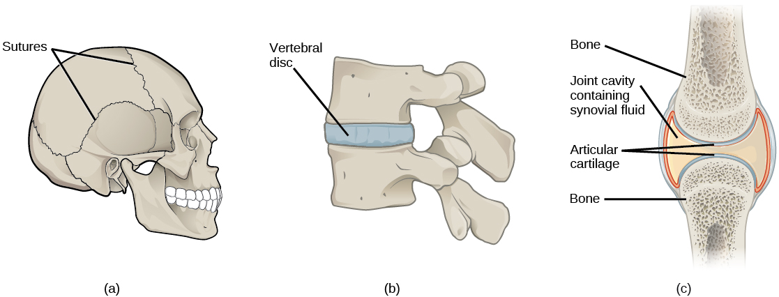 Illustration A shows sutures that knit the back part of the skull together with the front and lower parts. Illustration B shows 2 vertebrae with a cartilaginous disc between, holding the 2 vertebrae firmly together. Illustration C shows a synovial joint between two bones. An I-beam–shaped synovial cavity exists between the bones, and articular cartilage wraps around the tips of the bones. Ligaments connect the two bones together.