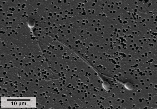 Micrograph shows human sperm, which have an oval head about 3 microns across and a very long flagellum.