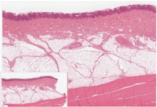 The outer layer of cells in this micrograph is the thinnest layer and stained deep purple due to full keratinization of dead cells. The next layer occupies one quarter of the micrograph, is lightly stained, and is a dense collection of cells. The third layer from the top is mostly white, with lightly stained, loosely-packed strands radiating in random directions. The bottom-most layer is densely-packed, with thick bands of highly organized muscle tissue that are darkly stained.