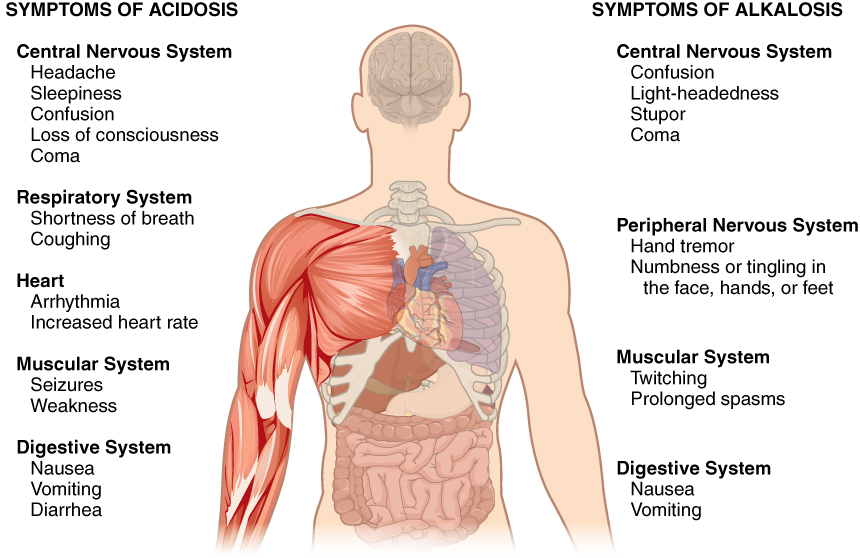 This figure points out the symptoms of acidosis and alkalosis on a silhouette of a human torso. The effects of acidosis on the central nervous system include headache, sleepiness, confusion, loss of consciousness and coma. The effects of acidosis are given on the left side of the diagram. The effects of acidosis on the respiratory system include shortness of breath and coughing. The effects of acidosis on the heart include arrhythmia and increased heart rate. The effects of acidosis on the muscular system include seizures and weakness. The effects of acidosis on the digestive system include nausea, vomiting and diarrhea. The right side of the diagram describes the symptoms of alkalosis. The effects of alkalosis on the central nervous system include confusion, light-headedness, stupor, and coma. The effects of alkalosis on the peripheral nervous system include hand tremor and numbness or tingling in the face, hands, and feet. The effects of alkalosis on the muscular system include twitching and prolonged spasms.  The effects of alkalosis on the digestive system include nausea and vomiting.