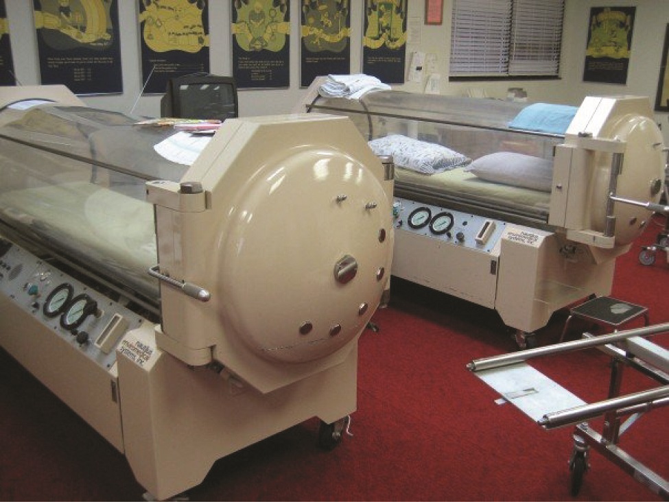 This photo shows two hyperbaric chambers.