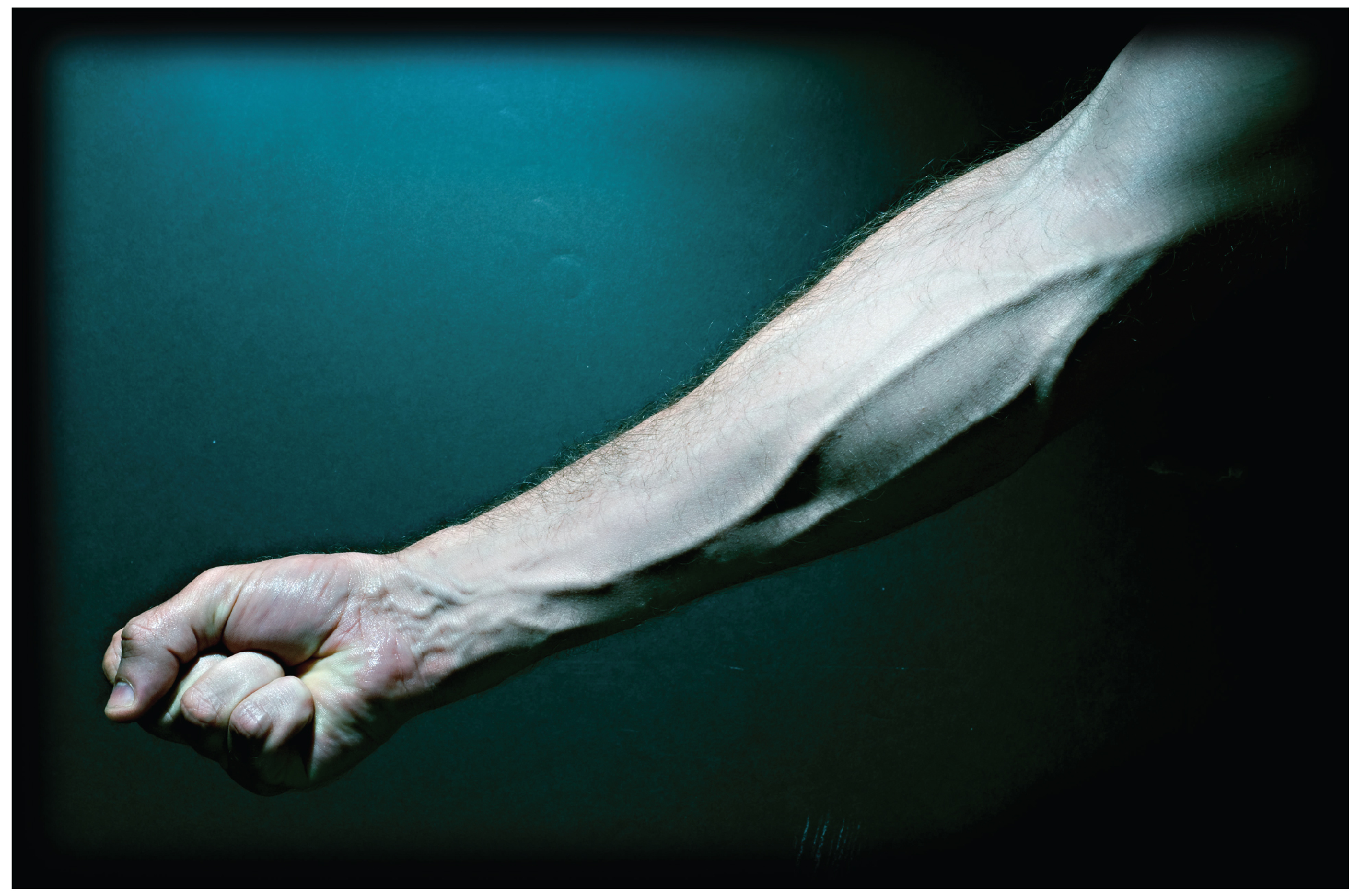 This photo shows a forearm with the veins bulging.