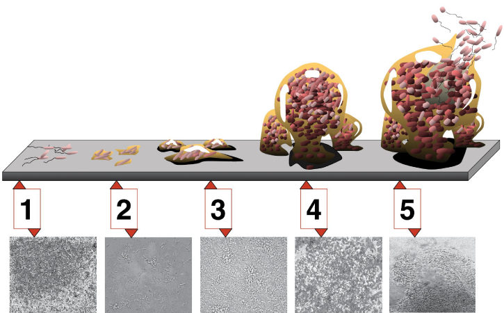 During the first stage of biofilm development, a few bacteria adhere to a surface. During stage 2, the bacteria grow hairy appendages called pili. During stage 3, the microfilm grows into lumpy colonies. In stage 4, the microfilm grows into a more ball-like shape that is anchored to the surface by a smaller clump of bacteria. In stage 5, the ball of bacteria is larger, and bacteria with flagella swim away.