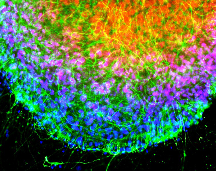 A colorful microscope image of chicken cells is shown. The nuclei of cells glow blue while the neurofilaments that connect these cells glow green under ultraviolet light.