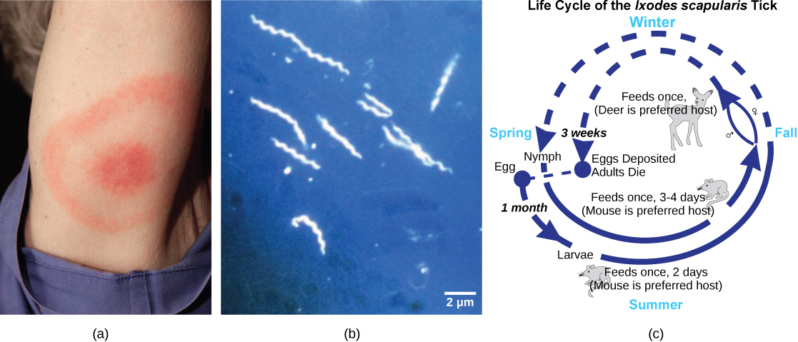 Part A shows the red, bullseye-shaped rash of a person infected with Borellia. Part B shows a micrograph of Borellia, which look like tiny corkscrews. Part C shows the life cycle of the bacteria, which begins when Borellia infect a tick egg. The egg hatches into larva, which feeds on a mouse, then into a nymph, which also feeds on a mouse. The nymph feeds again, this time on a deer, or sometimes a human.