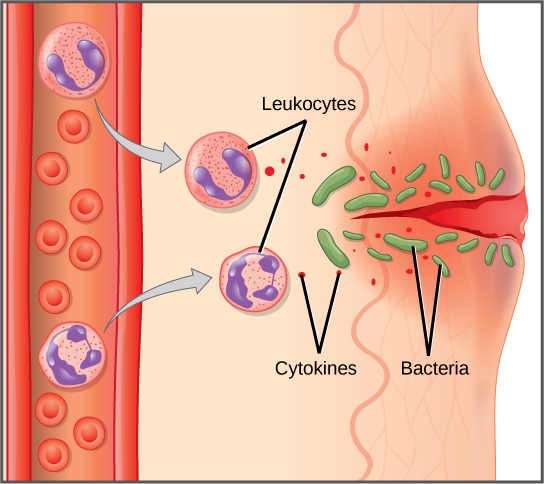  Illustration shows a capillary near the surface of skin that has a cut in it. Bacteria have penetrated the skin around the cut. In response, mass cells in the lower part of the skin tissue release histamines, and dendritic cells release cytokines. The histamines cause the capillary to become permeable. Neutrophils and monocytes exit the capillary into the damaged skin. Both the neutrophil and macrophage release cytokines and consumes bacteria by phagocytosis.