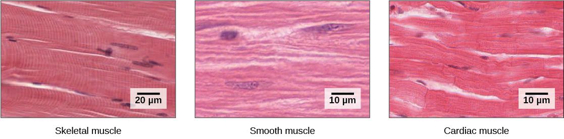  The skeletal muscle cells are long and appear striated due to the arrangement of their myofilaments. Each cell has multiple nuclei. Smooth muscle cells have no striations and only one nuclei per cell. Cardiac muscle cells are striated but have only one nucleus. The cells are arranged in branching bundles.