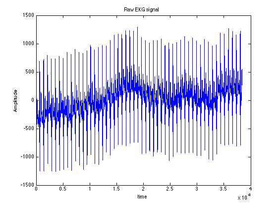 ekg raw 1