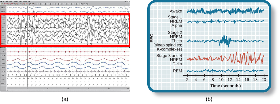 Polysonograph a shows the pattern of delta waves, which are low frequency and high amplitude. Delta waves are found mostly in stages 3 and 4 of sleep. Chart b shows brainwaves at various stages of sleep, with stages 3 and 4 highlighted.