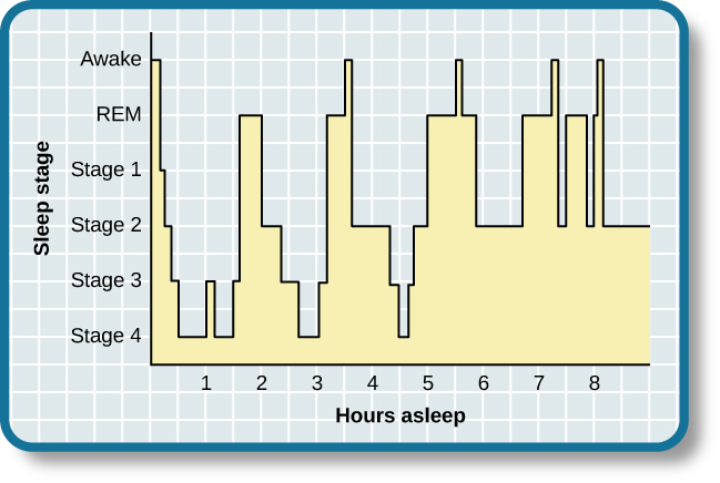 This is a hypnogram showing the transitions of the sleep cycle during a typical eight hour period of sleep. During the first hour, the person goes through stages 1,2,3 and ends at 4. In the second hour, sleep oscillates between 3 and 4 before attaining a 30-minute period of REM sleep. The third hour follows the same pattern as the second, but ends with a brief awake period. The fourth hour follows a similar pattern as the third, with a slightly longer REM stage. In the fifth hour, stages 3 and 4 are no longer reached. The sleep stages are fluctuating from 2, to 1, to REM, to awake, and then they repeat with shortening intervals until the end of the eighth hour when the person awakens.