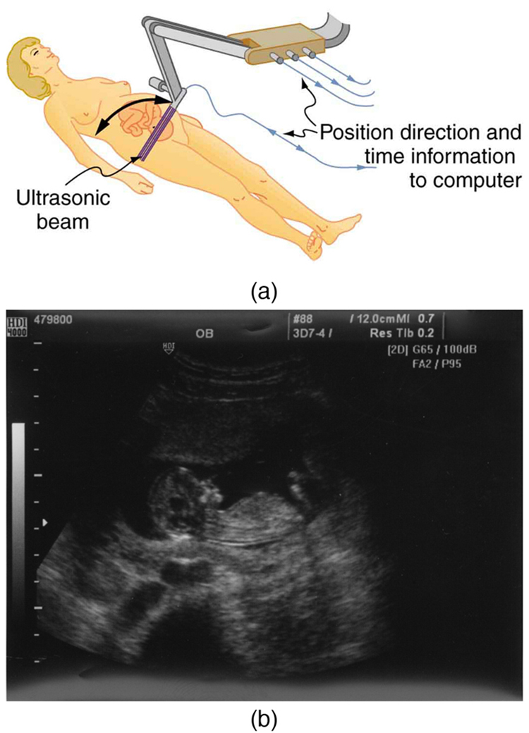 The first part of the diagram shows an ultrasound device scanning a woman’s abdomen. The second part of the diagram is an ultrasound scan report of the abdomen.