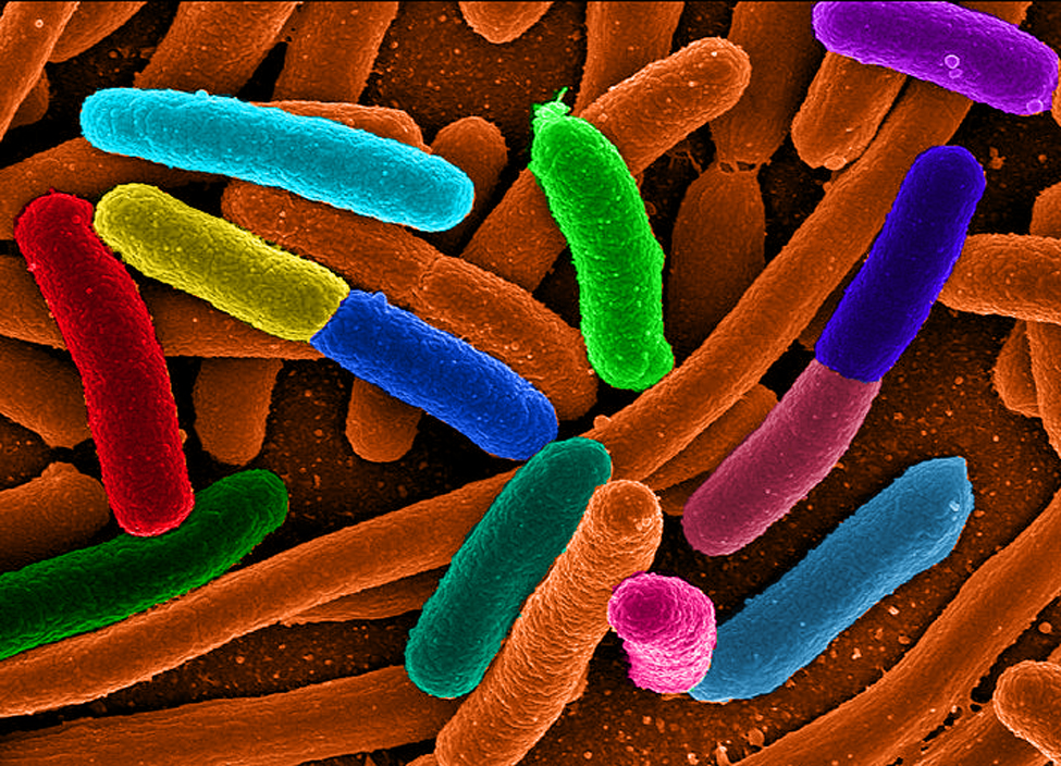 Escherichia coli (e Coli) bacteria