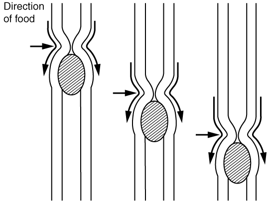 This image shows the peristaltic movement of food. In the left image, the food bolus is towards the top of the esophagus and arrows pointing downward show the direction of movement of the peristaltic wave. In the center image, the food bolus and the wave movement are closer to the center of the esophagus and in the right image, the bolus and the wave are close to the bottom end of the esophagus.