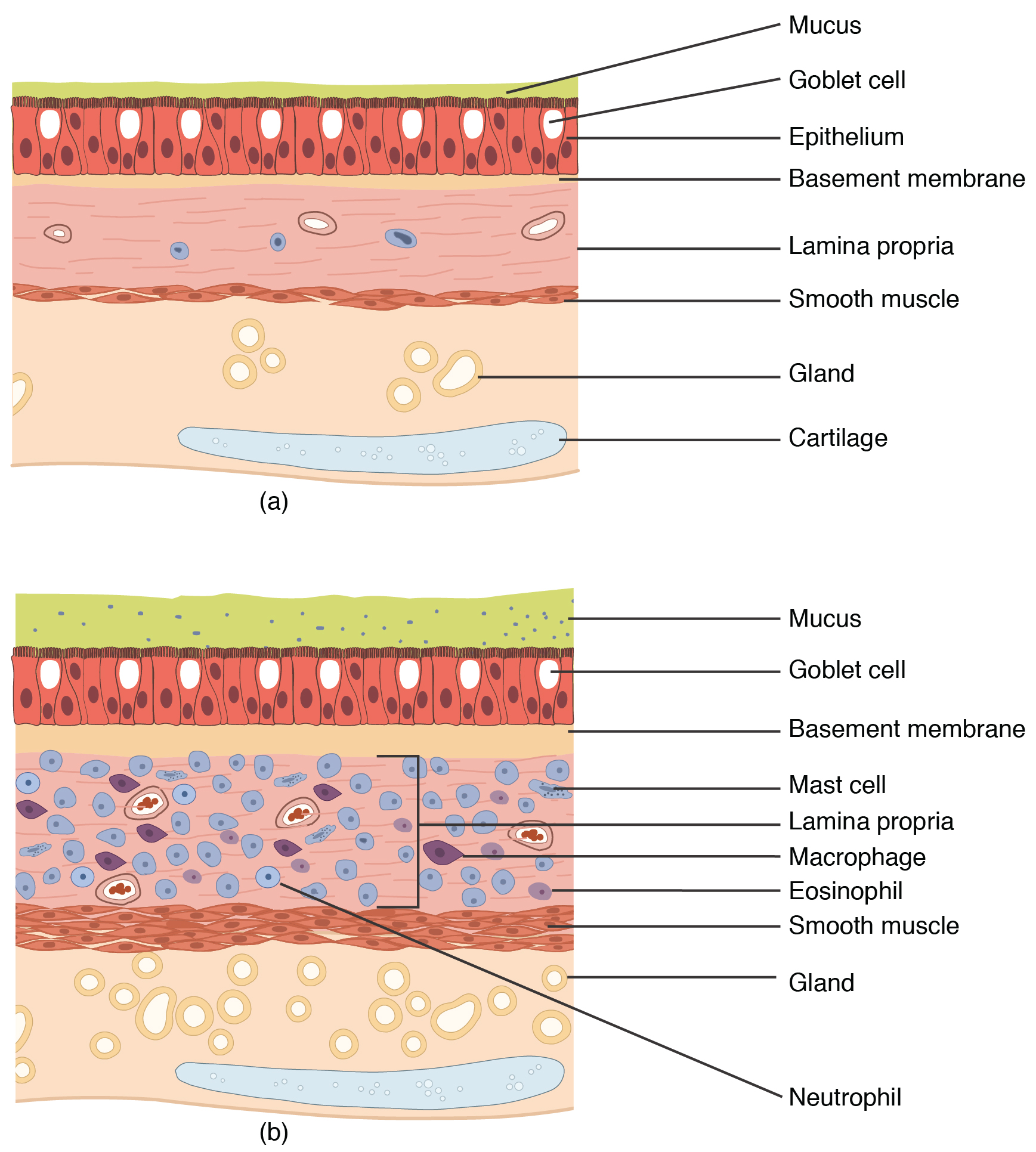 The top panel of this figure shows normal lung tissue, and the bottom panel shows lung tissue inflamed by asthma.