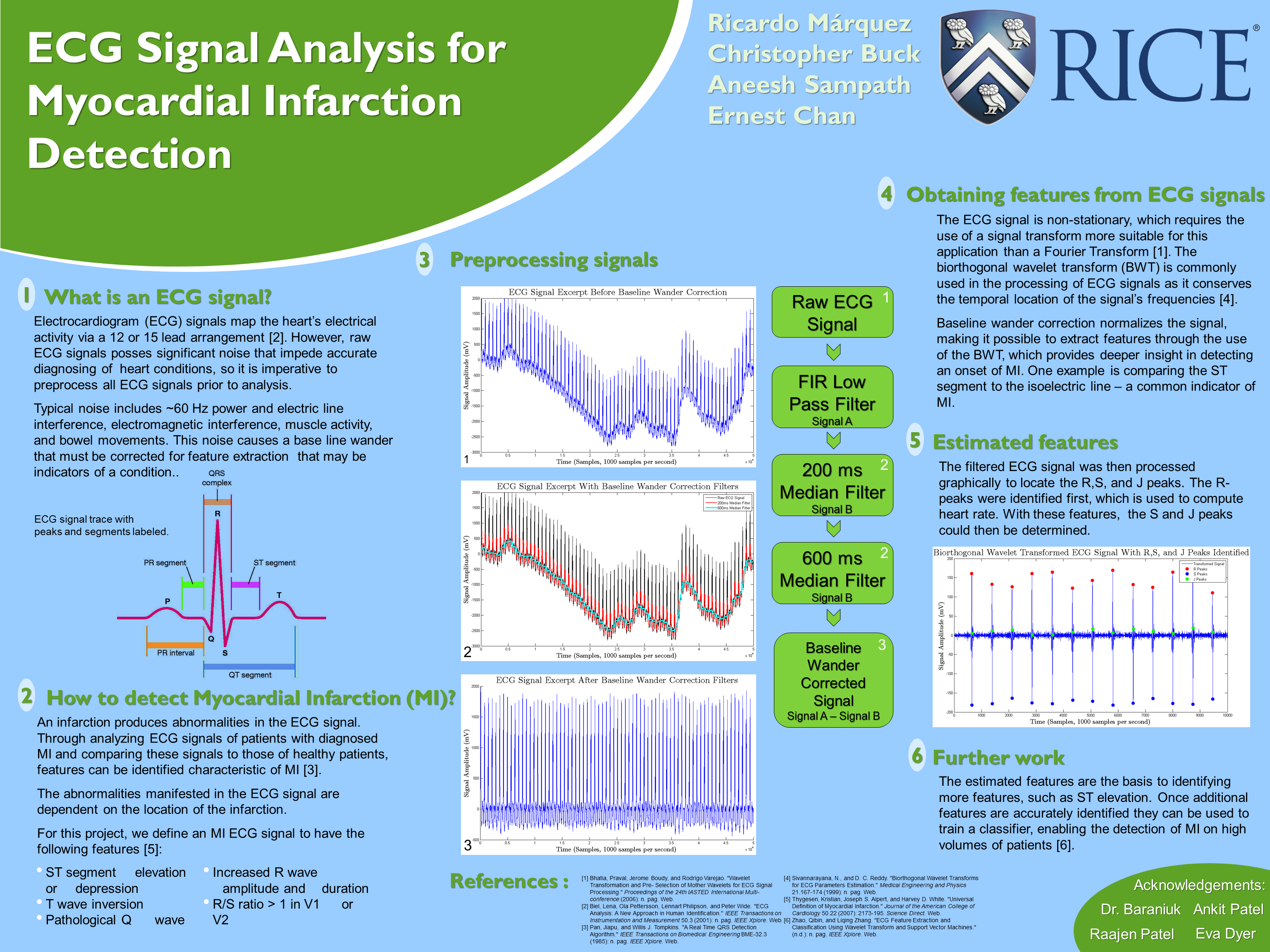 ECG final poster