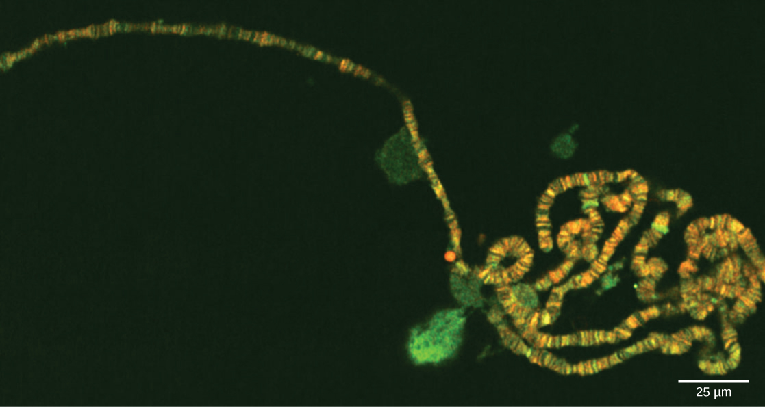 Electron micrograph shows a long, thin chromosome that has a banding pattern.