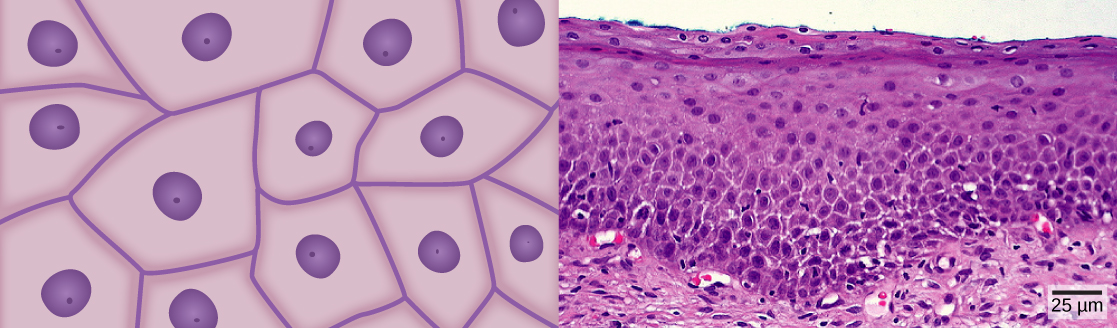 Illustration A shows irregularly shaped cells with a central nucleus. Micrograph B shows a cross section of squamous cells from the human cervix. In the upper layer the cells appear to be tightly packed. In they middle layer they appear to be more loosely packed, and in the lower layer they are flatter and elongated.