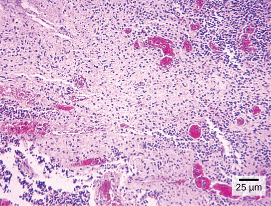 Part a: Salmonella through a light microscope appear as tiny purple dots.