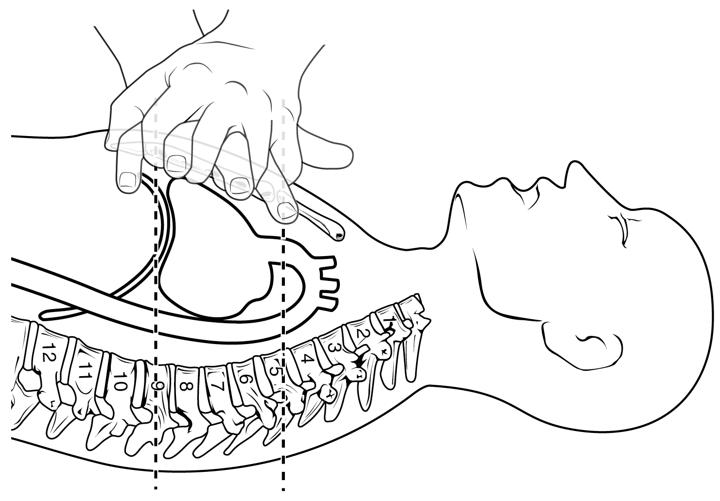 The top panel shows a schematic of a person performing CPR and demarcates the region in the chest where the compression must be performed. The bottom panel shows a photo of a person performing CPR on a dummy.