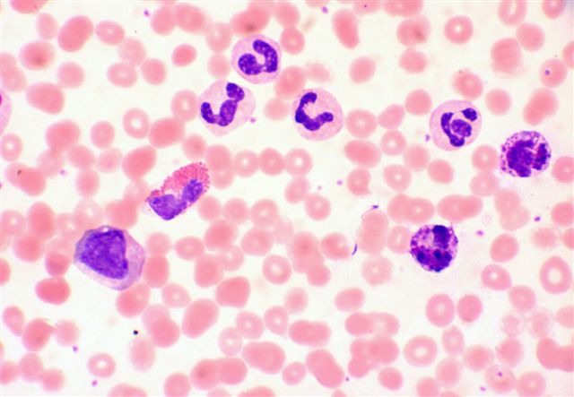 Blood smear example.