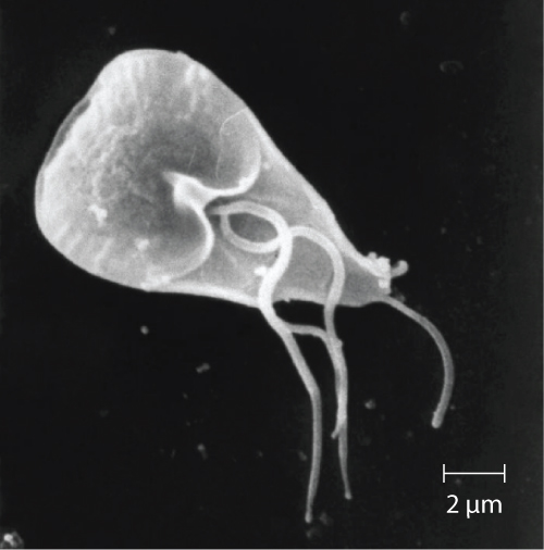 An SEM micrograph showing a triangular cell with three long, thin projections; one from the end and two from the middle of the cell. The cell is approximately 3 x 8 µm in size.