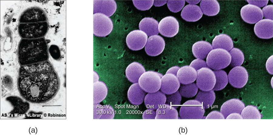 Figure a shows A TEM micrograph with a clear background and a dark cell in the center. A double line outlines the edge of the cell and webs of material inside the cell are visible. Figure b shows an SEM micrograph that has large purple clusters on a green background with small holes. The three dimensionality of the purple clusters is apparent.