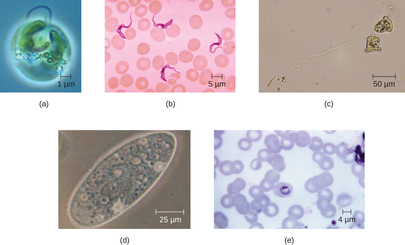 a) A micrograph of a spherical cell approximately 4 µm in diameter. B) A micrograph of wavy ribbon shaped cells approximately 10 µm in length. C) a micrograph of a bell shaped cell approximately 50µm in diameter with a tail approximately 200 µm in length. D) An oval shaped cell approximately 100 µm in length. A ring shaped cell approximately 4 µm in diameter; the ring shaped cell is inside a red blood cell.