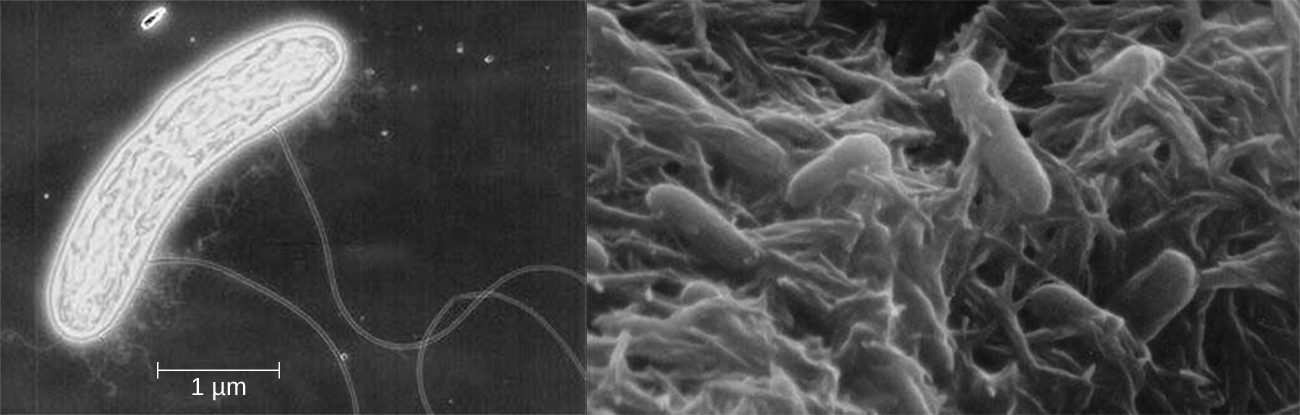 A micrograph of a rod shaped cell with long projections. The cell is approximately 5 µm long. Another micrograph showing many rod shaped cells attached to a matrix.