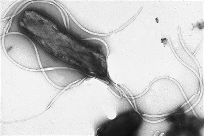 A micrograph of a rod shaped cell with many long projections.