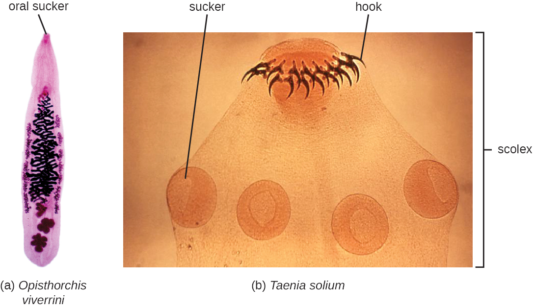 a) A micrograph of Opisthorchis viverini; an oval cell with a projection at one end. B) A micrograph of one end of Taenia solium showing a whorl of small projections above an area labeled scolex.