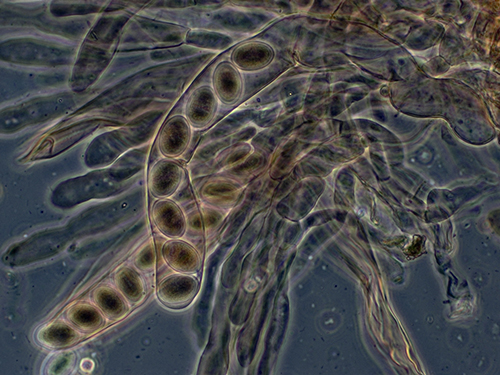 A micrograph showing a thick tube with 8 ovals lined up within the tube.