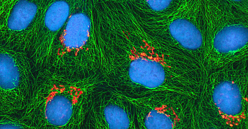 Each cell contains a large blue sphere with a cluster of orange ovals next to the sphere. A green web fills the rest of the cell.