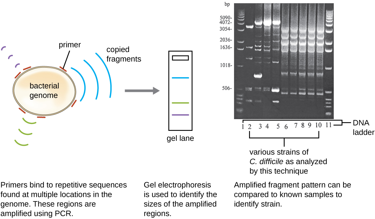 A diagram of molecular analysis. A circular bacterial genome is shown. Primers bind to repetitive sequences found at multiple locations in the genome. These regions are amplified using PCR. Gel electrophoresis is used to identify the size of the amplified regions. Amplified fragment patters can be compared to known samples to identify strains.