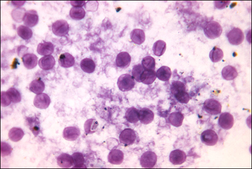 Micrograph of dark purple circles on a light purple background.