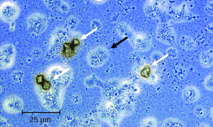 Micrograph showing  oddly (roughly round) shaped structures.