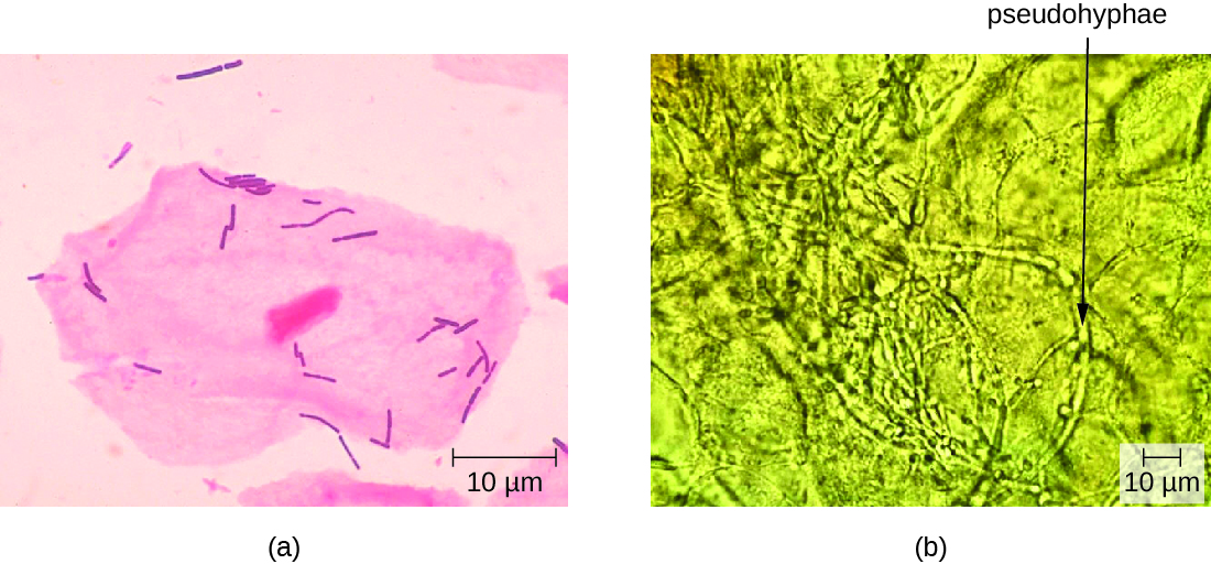 a) micrograph of large pink cell with a nucleus and smaller pink rod shaped cells. B) Micrograph of long tubes labeled pseudohyphae.