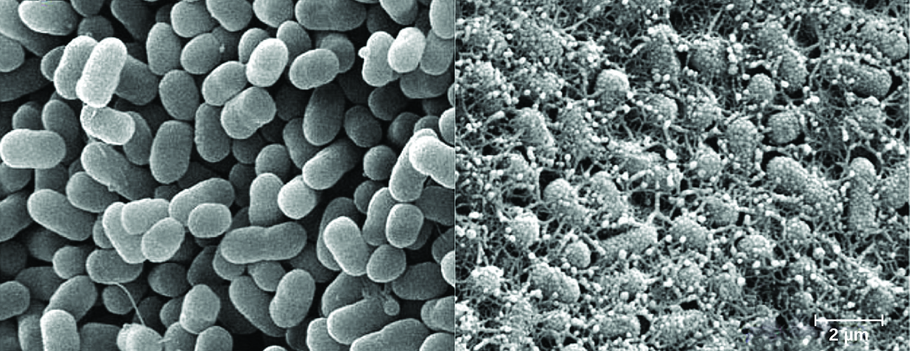 Micrograph of oval cells with and without projections.